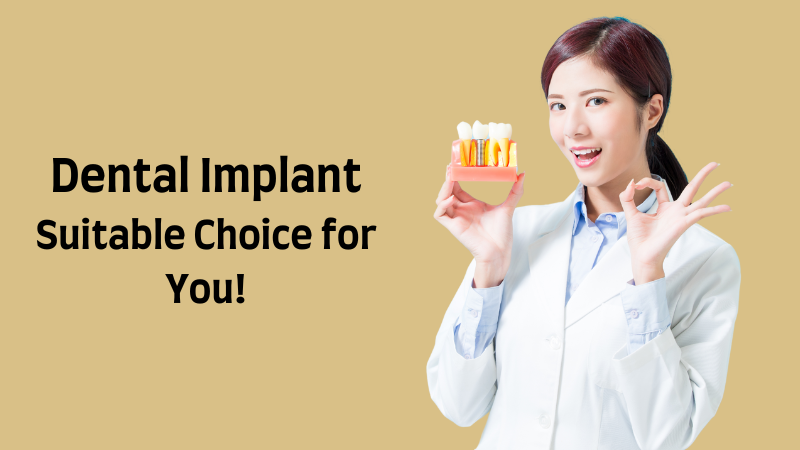 dental implant for molars the suitable choice for you